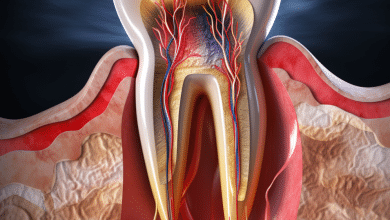 Tooth With Root Canal Hurts With Pressure
